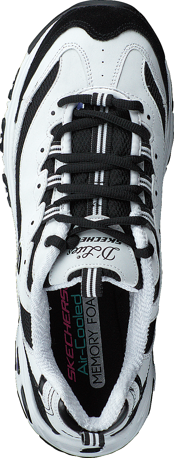 Skechers store march forward
